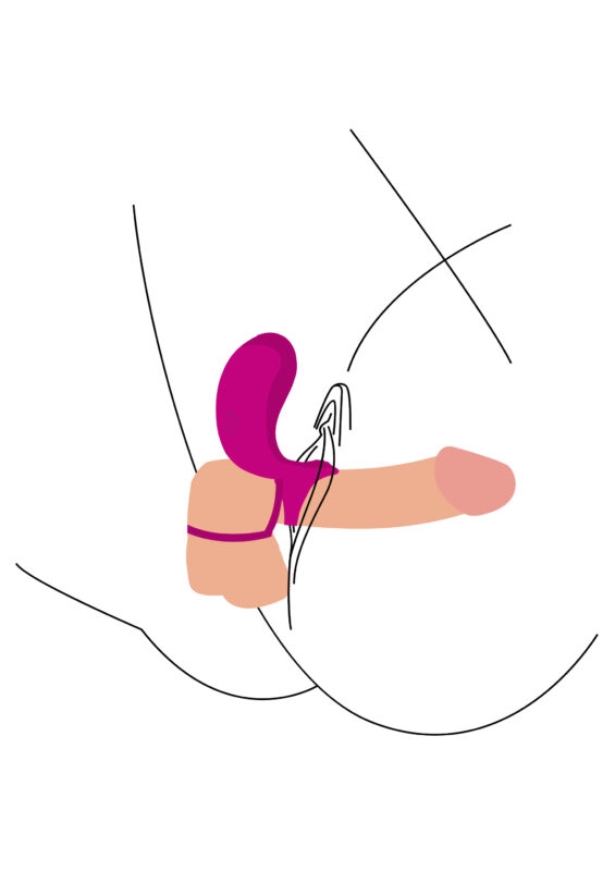 Paare Stimulator Ring – Bild 5